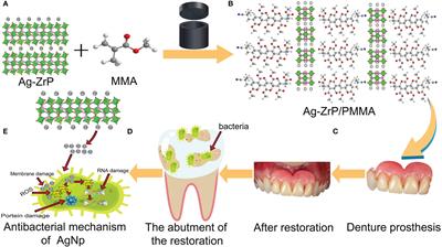 The effects of nano-silver loaded zirconium phosphate on antibacterial properties, mechanical properties and biosafety of room temperature curing PMMA materials